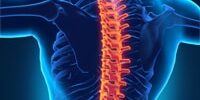 compression-fracture